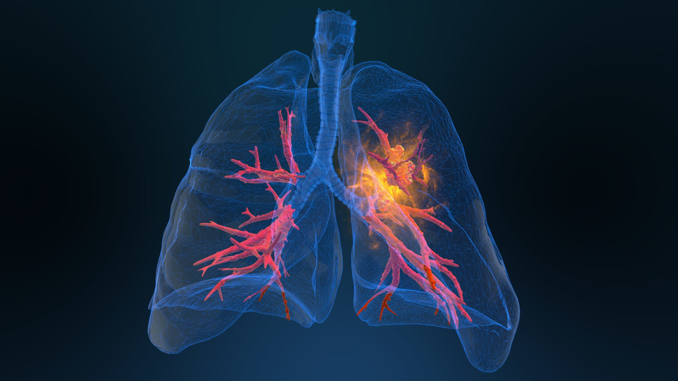 N-acetyl L-cysteine’s (NAC) effect on lung function